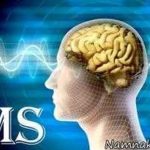 زنان فاقد درآمد، بیشترین مبتلایان به ام اس در همدان/ هزینه درمان ماهی یک میلیون‌تومان