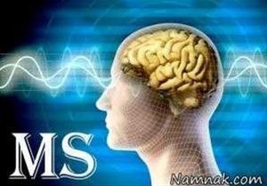 ناتوانی مالی مانع خرید لوازم طبی برای بیماران مبتلا به ام اس شده است